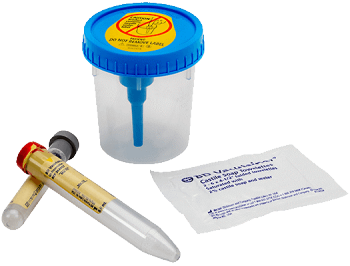 BD 364957 Vacutainer® Complete Urine Collection System with Preservative Tube